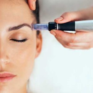 Esthétique Médicale - Traitements anti-âge Micro Needling